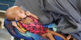 Drought puts 1.4 million children at risk of acute malnourishment