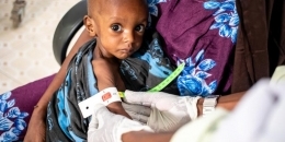 Somalia: Severe Malnutrition Among Children Soars 300% Since January