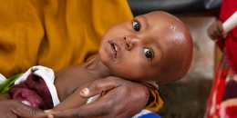 As hunger bites in Somalia, babies start to die
