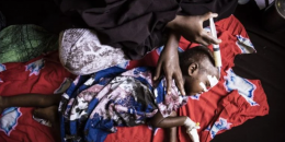 Too weak to cry: famine looms over Somalia’s children