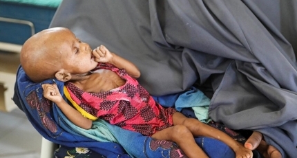At least 200 children die in Somalia from malnutrition