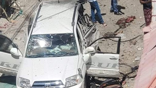 Somali Govt spokesman wounded in suicide attack